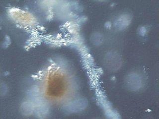 Fungi attacked by bacteria in anaerobic