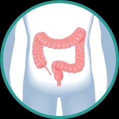 A colonoscopy can find polyps so that they can be removed before they turn into cancer.