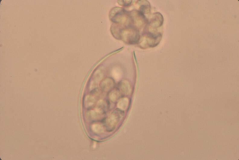 Or if water is present, zoospores are formed.