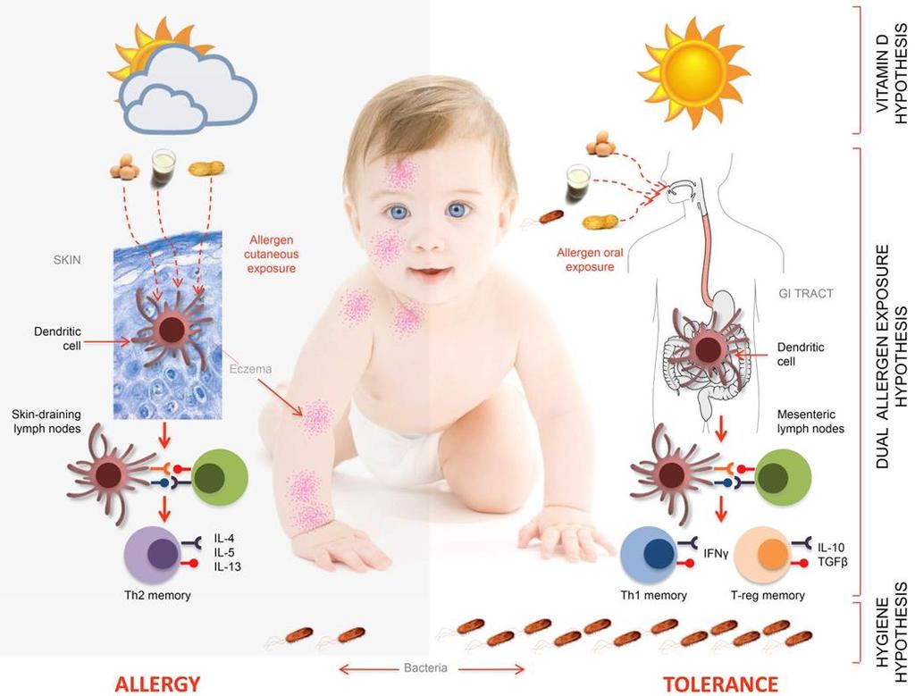 Dual allergen exposure hypothesis Journal of Allergy and