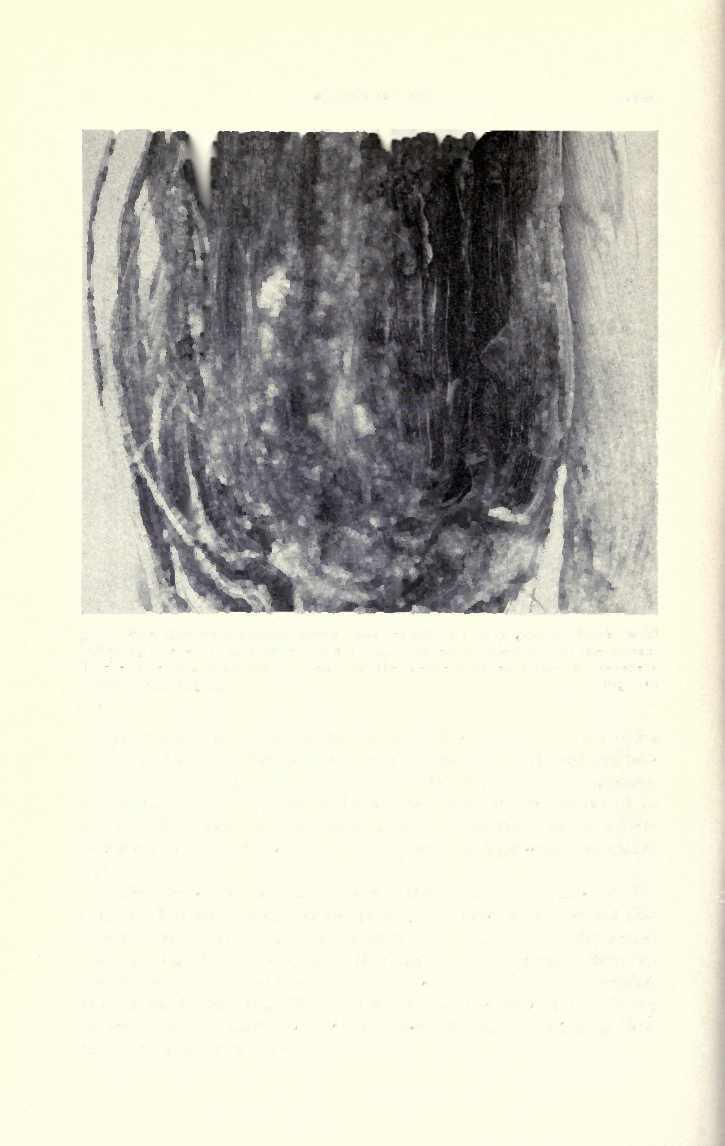20 BULLETIN NO. 639 [March, Early infection with Physalospora zeae results in a dark gray to black mold covering the ears, and little black dots, apparently sclerotia, in the husks.