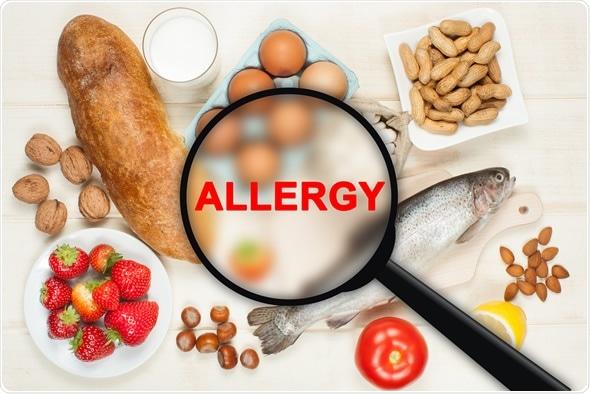 Agenda Introduction What are Food Allergies Top Eight Allergens Causes/Current research