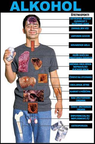 Slika 1. Posljedice alkoholizma na ljudsko zdravlje Izvor: http://majoj.wordpress.com/2013/01/08/4/ 1.5.