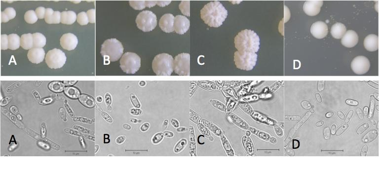 Figure 2. Samples of colony (top row) and cell (bottom row) morphologies. A, Bret t anomyces bruxellensis; B, Candida diversa; C, Issat chenkia t erricola; D, B. anomalus.