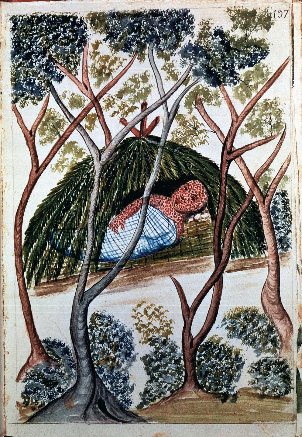The Scourge of Smallpox This Peruvian infant, depicted about 1700, was