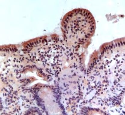 expression in intestinal