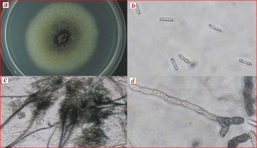 Slika 19. Colletotrichum sp. izolata Coll-44: Izgled kolonija 7 dana starih na PDA (a), konidija (b), seta (c) i apresorija (d) Izolat Coll-44 identifikovan kao Colletotrichum sp.