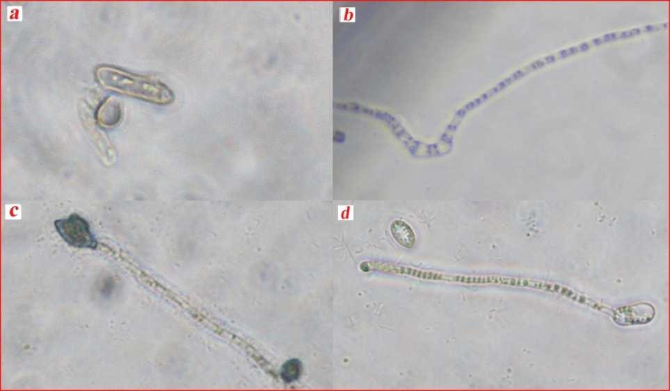 Slika 20. Klijanje konidija proučavanih izolata Colletotrichum spp. Formiranje apresorije direktno na konidiji izolata Coll-44 (Colletotrichum sp.