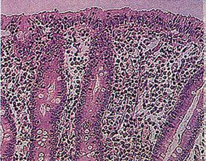 Anatomy - Villi Villi are 1mm finger-like projections that line the inside of the small intestine, containing capillaries.