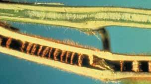 Anthracnose is most common as a pod and stem disease during later reproductive stages of growth. Irregularly shaped brown areas may develop on stems, petioles and pods.