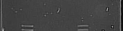 aureus IM 389 Staph.