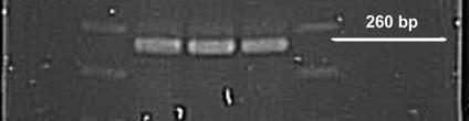 2 REZULTATI ANALIZE PCR Z analizo PCR smo potrdili, da sta vzorca S4 in S7