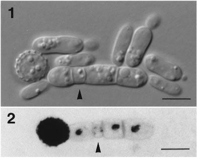 Teliospore germination of anther-smut fungi 534 Figs 1 2. Germination of teliospores of Microbotryum violaceum f. sp. caroliniana.