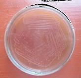 Plate 8: Enterococci spp on Macconkey agar Plate 13: Klebsiella