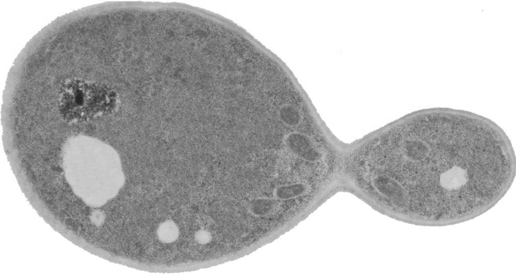 (e) Fig. 1.2 shows yeast as seen using a microscope. 6 P Q x 5000 Fig. 1.2 (i) Name the process that is occurring in Fig. 1.2.... [1] (ii) You are going to calculate the actual length of a yeast cell shown in Fig.