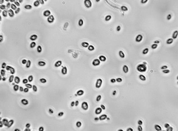 cerevisiae, Torulopsis fermentans, Torulopsis sexta) Classification