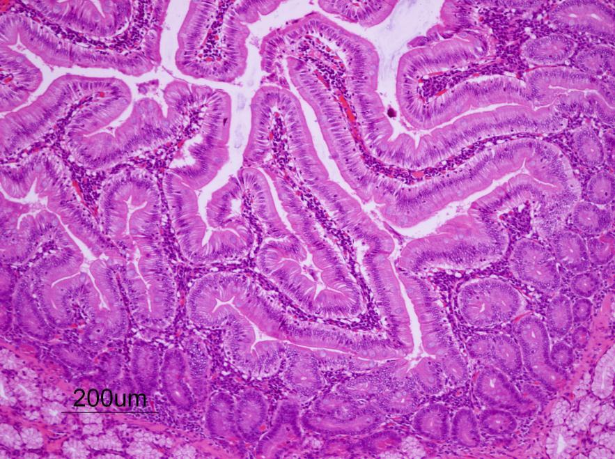 Histology: Phase I Duodenal tissues from a