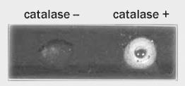 Catalase-negative If bacteria produce O 2 from H 2 O 2 they are catalase-positive Heterotrophic vs.