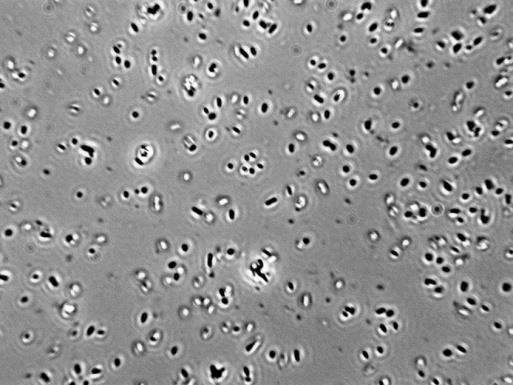 Lactobacillus brevis Lactobacillus hilgardii Lactobacillus fermentum Heterofermenters