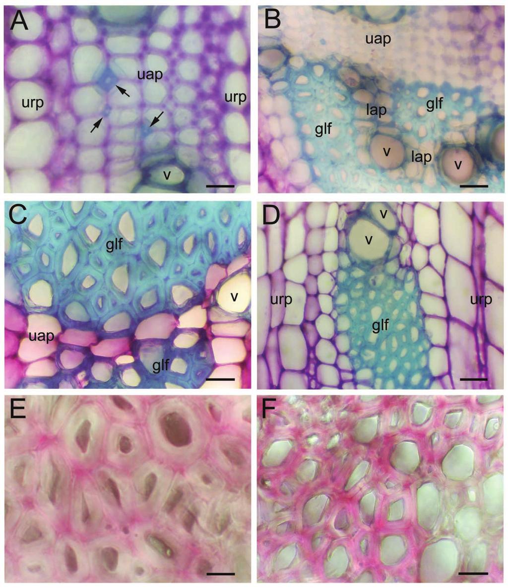 Fig. 4 Photomicrographs of cross sections for reaction wood in sub-subterminal cladode junctions.