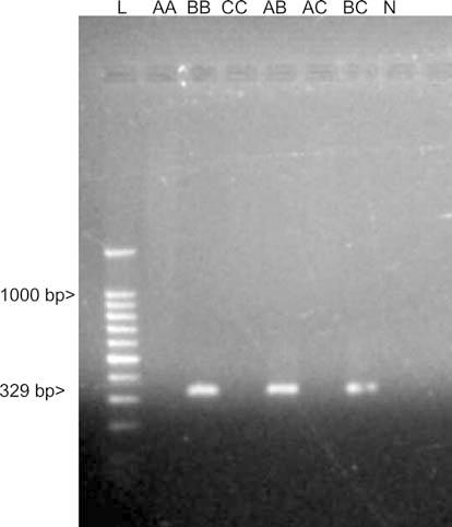 919 (0.3 M NaCl, 0.03 M Na Citrate) using a Bio-Rad (Hercules, Calif.) slot blot apparatus. Following blotting, the membrane was rinsed in 2 SSC, blotted again and dried at 60 C for 30 min.