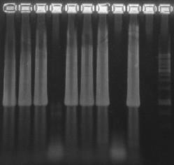 Reactions were performed in 96-well plates using Bio-Rad thermal cycler in 25µl total volume, including 5µl of DNA and 2X Platinum qpcr Supermix-UDG (Invitrogen). The concentration of primers was 0.