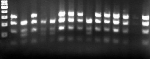 RFLP patterns were obtained after digestion of PCR products with AluI (A), Tru1l (B), TasI (C) and