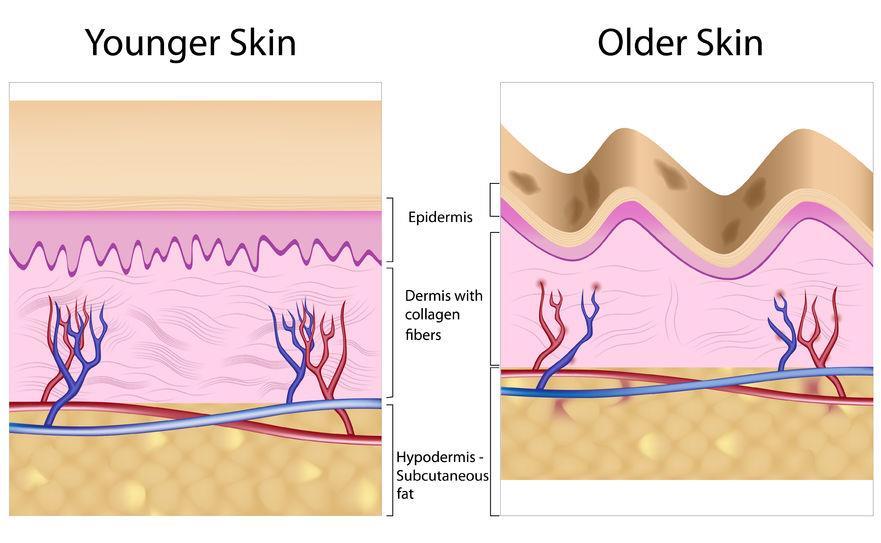 SKIN AGING AND WRINKLE FORMATION Skin aging is noted by a decrease of elasticity formation of wrinkles and fine lines degradation of collagen thinner and weaker skin damaged connective tissues Skin