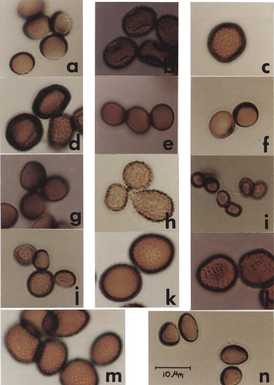 V. Crotzer, E. Levetin /Aerobiologia 12 (1996) 177-184 179 Fig. 1. Teliospores of Ustilago species identified on Oklahoma crops. (a) U. avenae, (b) U. boutelouae, (c) U.