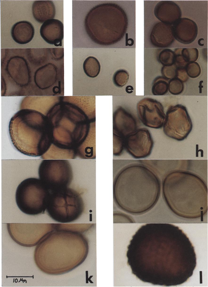 V. Crotzer, E. Levetin /Aerobiologia 12 (1996) 177-184 181 Fig. 2. Teliospores of non-ustilago smut species identified on Oklahoma crops.