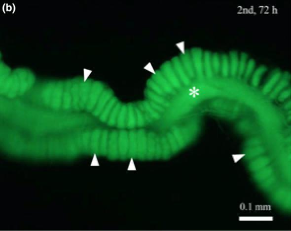 Bacterial Endosymbionts Example: Burkholderia (Beta-Proteobacteira) Gut symbiont found in phytophagous insect hosts such as pentatomid stink bugs