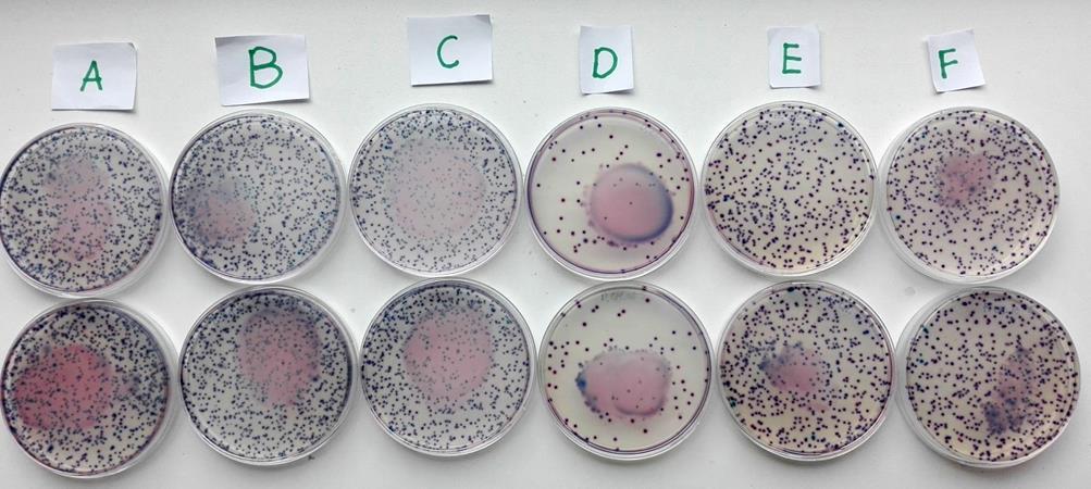 Coliform Count Plates: A-tap water (control), B-distilled water (control), C-alkaline,