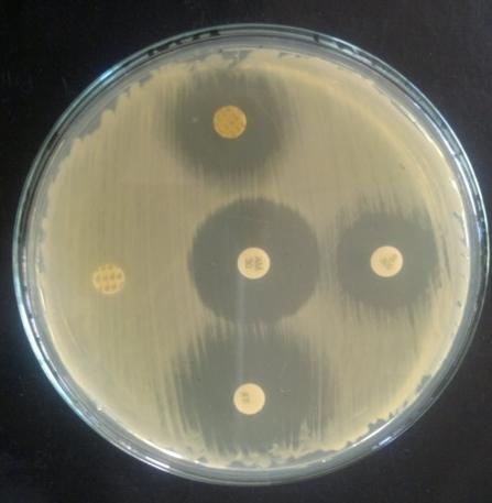 TC IC50 Pathogens (µg ml -1 ) (µg ml -1 ) L. monocytogenes P. aeruginosa B. cereus S. aureus E. coli PF-1 1-18 176.00 g 1.487 a NZ NZ NZ NZ NZ PF-2 19-21 1842.55 a 0.