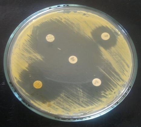 aureus against standard antibiotics Staphylococcus aureus (MTCC-96) Listeria monocytogenes (MTCC-839) Pseudomonas aeruginosa