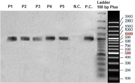 Fig. 32: The pcr amplification of the Agro-plasmid; (P.C.): Positive control; (N.C.): Negative control; (P1 - P5): Agro- plasmids Afterward, the stable transformation of Petunia hybrida was done.