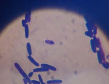 OF4 Long rod Bacteria Figure