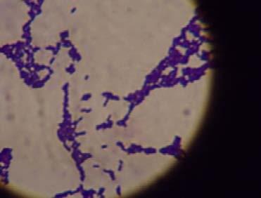 HM1 Long rod Bacteria 6.