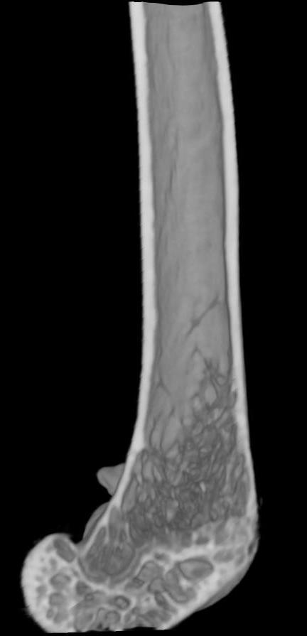 raspon za kortikalnu kost raspon za trabekularnu kost referentna točka odmak za kortikalnu kost odmak za trabekularnu kost A B Slika 2: Prikaz dijelova femura (A) i tibije (B) uzetih za