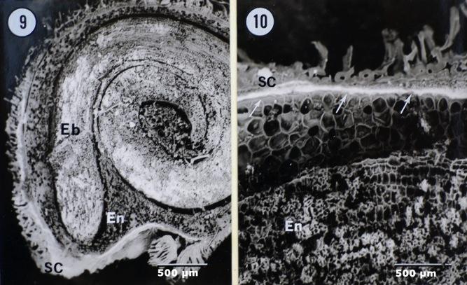 Electron Micrographs of Tomato Semipermeable layer (SPL) is