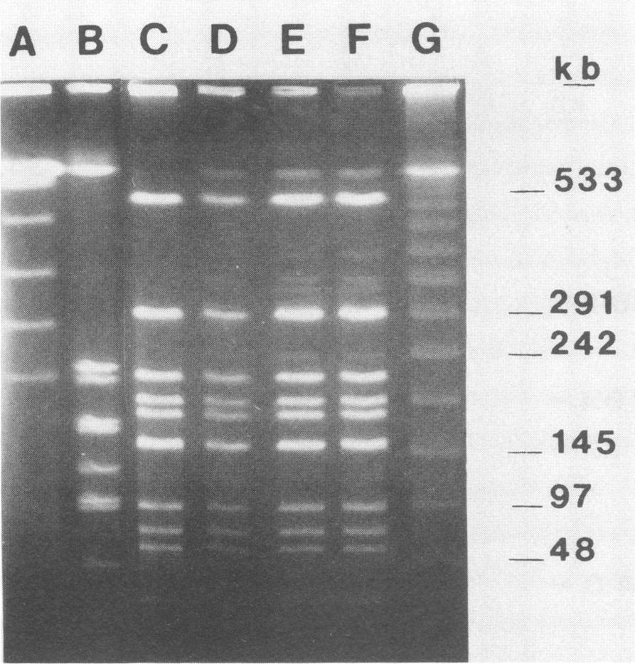The genomic fingerprints shown are identical to restriction profiles of each strain obtained in at least five replicate gels. tici (Fig. 1).