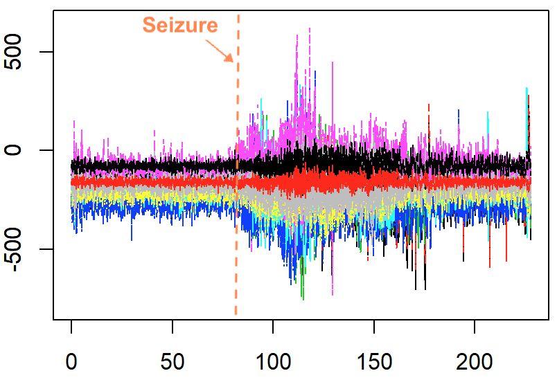 Addressing Non-Stationarity: Piecewise Stationary VARs Motivation: Analyzing EEG Data Brain