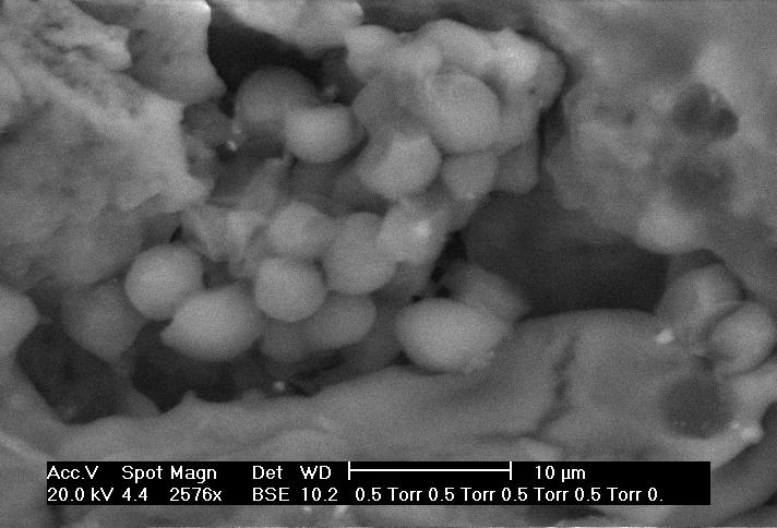 Scanning Electron Microscopy of an Ale