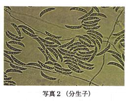 Pathogen Spores and black spines in