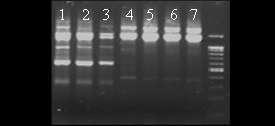 PCR Results 8 Lanes 1-3: Lanes 4-7: Lanes 1,