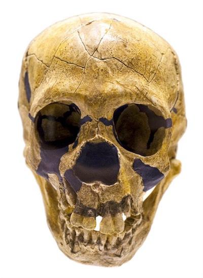 Notice the differences from modern human skulls,