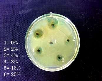 E.coli K. pneumoniae Fig (3): Antibacterial activity of Lime on tested bacteria The inhibition of by the two juice used was the same in some cases with that of standard antibiotics.