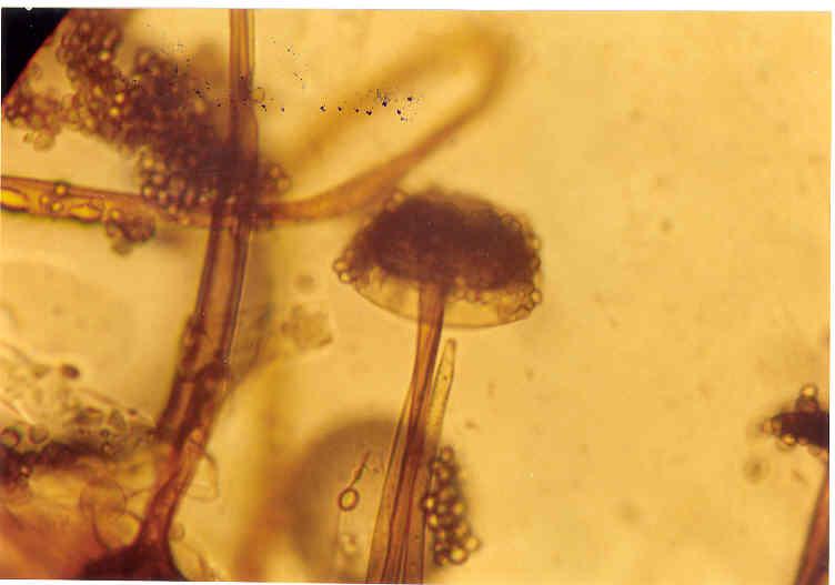 Fig. - Rhizoide(a), Sporangia(b), Columella