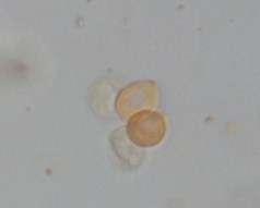 A B C D Figs. 95 (A-D) Termitomyces robustus: A. Basidiospores, B. Basidia, C.