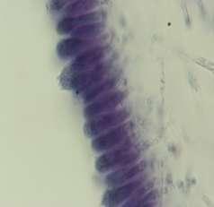 3 µm, narrowly clavate, siderophilous, inamyloid, tetrasporic; sterigmata 2.5-3.