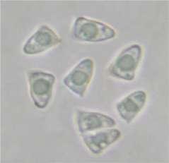 A B C Figs. 19 (A-C) Lepiota cristata: A. Basidiospores B. Pileus hymeniderm layer, C. Cheilocystidia.